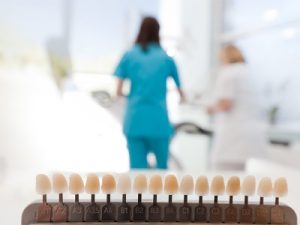 Estética-dental-barcelona-3