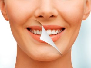 blanqueamiento-barcelona-2