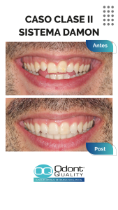 caso-real-damon-clinica-dental